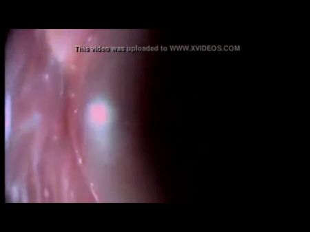 inside ass camera